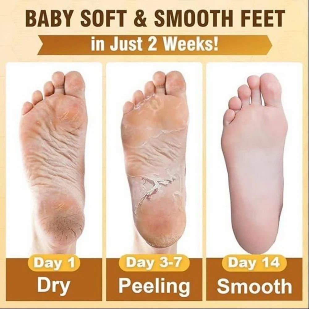 Foot Peel Mask for Women & Men | Peeling & Exfoliating Foot Mask for Dry Cracked Feet, Removes Dead Skin & Calluses, Hydrates & Smooths Cracked Heels (Chocolate, Pack of 1)