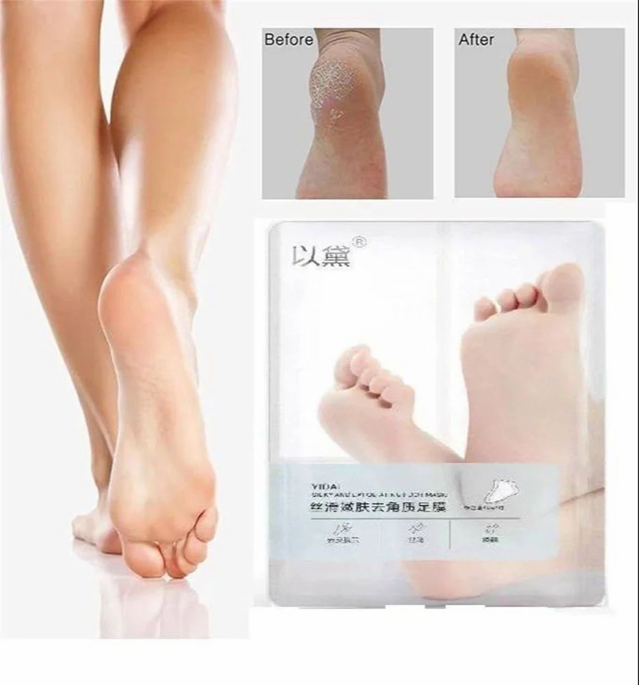 Foot Peel Mask for Women & Men | Peeling & Exfoliating Foot Mask for Dry Cracked Feet, Removes Dead Skin & Calluses, Hydrates & Smooths Cracked Heels (Chocolate, Pack of 1)